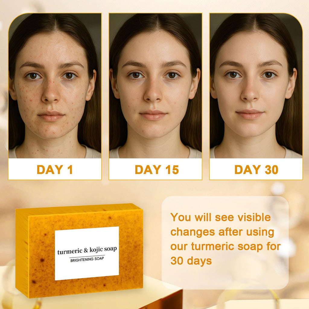 5 Pack Turmeric &Kojic Brightening Soap